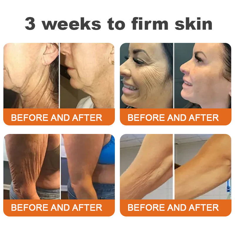 đđFlash Sale - â¨ODEIUN⢠BOTOX Bee Venom All-in-one Treatment Cream đĽ LAST DAY 80% OFF đđ
