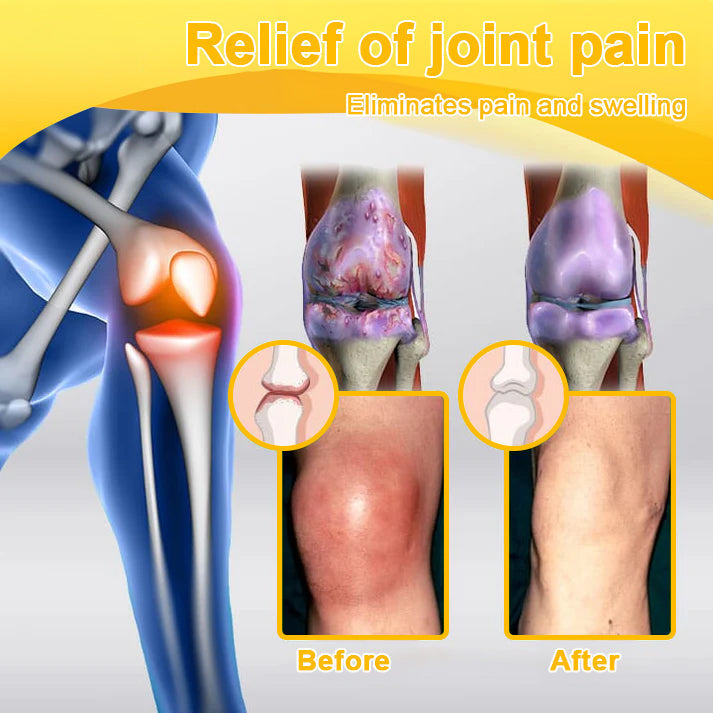 🎁💎Flash Sale - ODALIT™ Botulinum Toxin & Bee Venom Pain-Relief Bone Healing Cream🐝