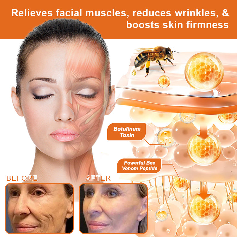 đđFlash Sale - â¨ODEIUN⢠BOTOX Bee Venom All-in-one Treatment Cream đĽ LAST DAY 80% OFF đđ